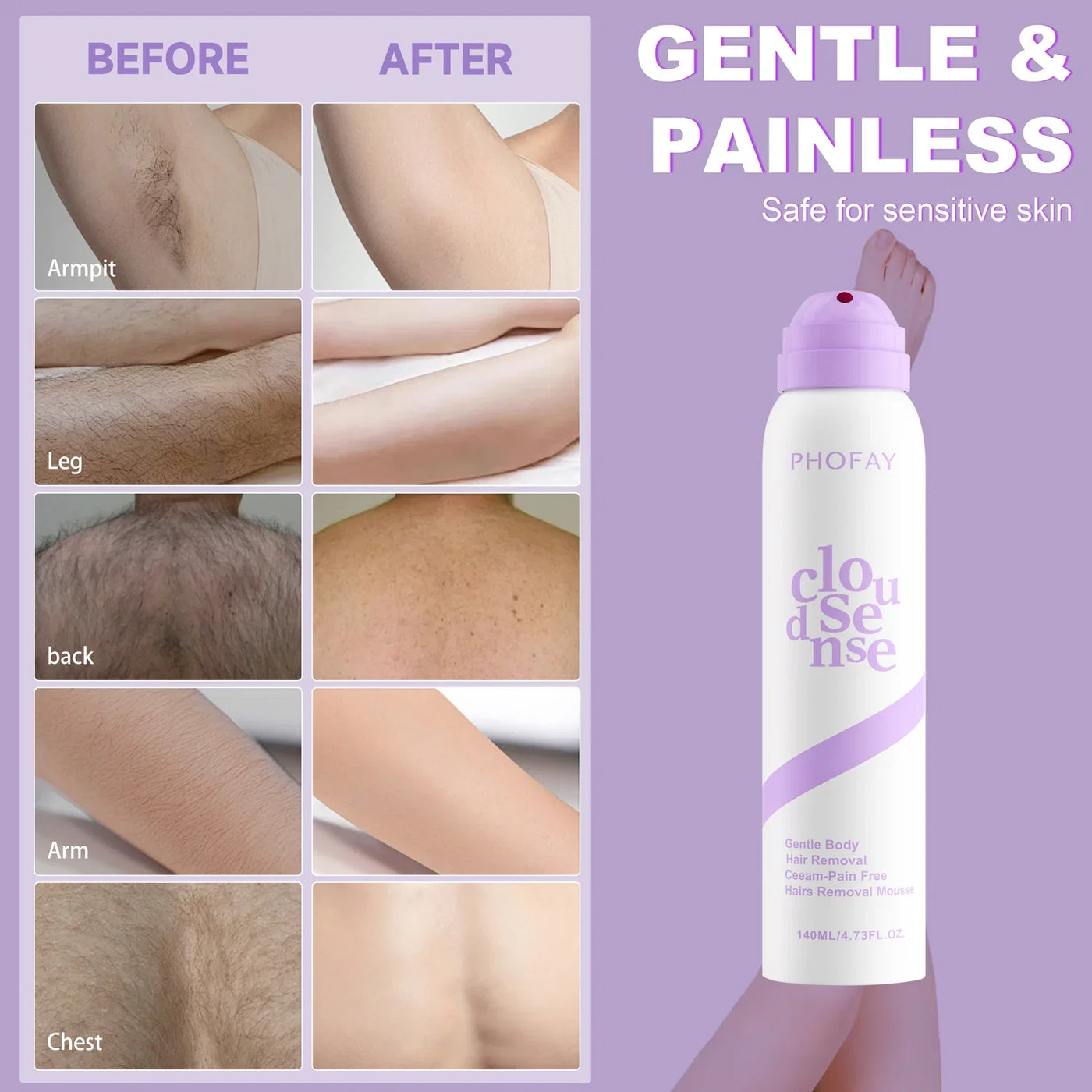PHOFAY Spray-On Hair Removal Mousse