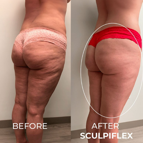 Sculpiflex Full Kit