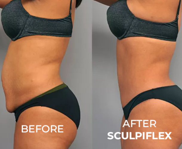 Sculpiflex Full Kit