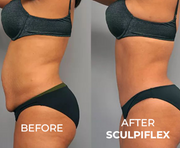 Sculpiflex Full Kit