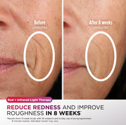 Shark CryoGlow Under-Eye Cooling + LED Mask
