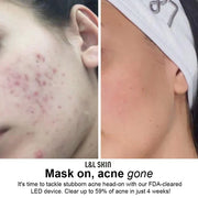 LUMI LED Light Therapy Skincare Mask